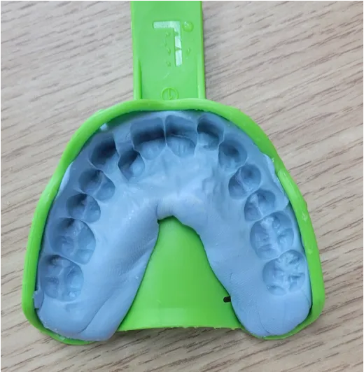 トレーを外して確認